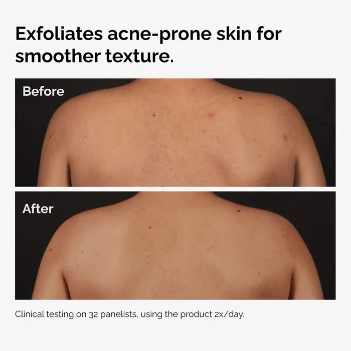 The Ordinary Salicylic Acid 0.5% Body Serum - Image 3