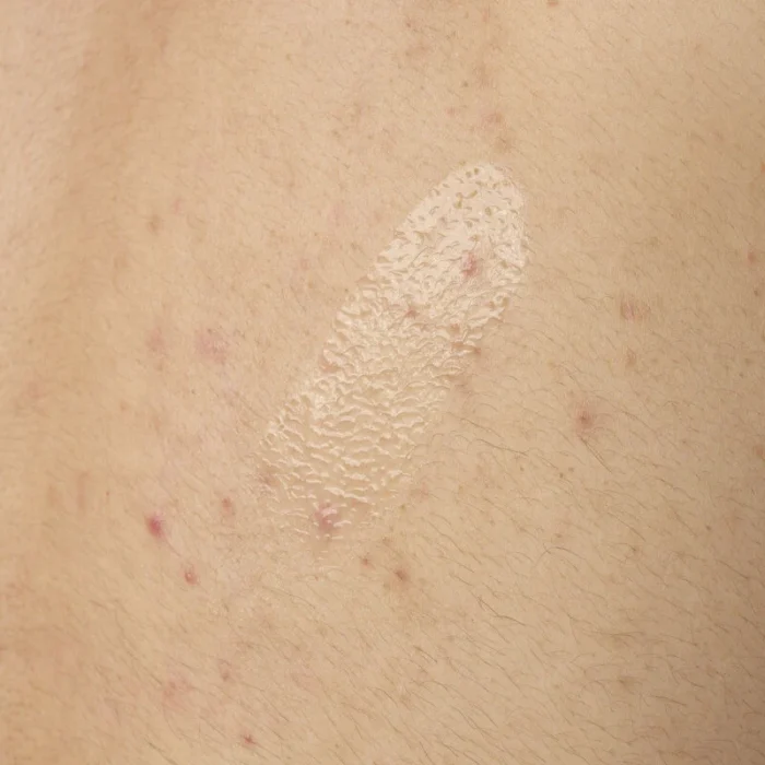 The Ordinary Salicylic Acid 0.5% Body Serum - Image 4
